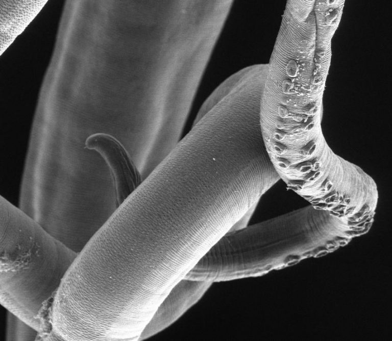 black and white image of a whipworm