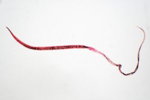 whipworm parasite
